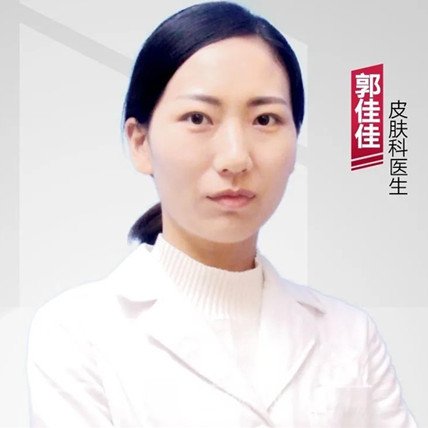 郭佳佳