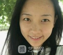 皮秒做过之后效果图案例