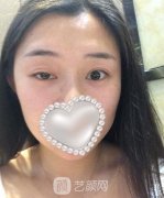 深圳曹思佳专家高难度双