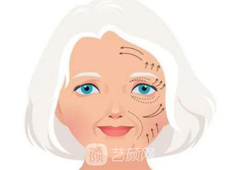 冯立哲面部提升价格是多