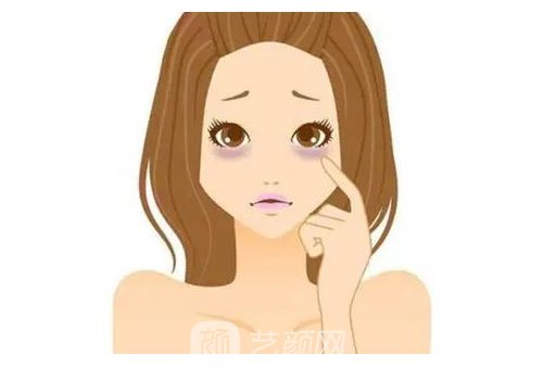 小切口筋膜悬吊术多少钱