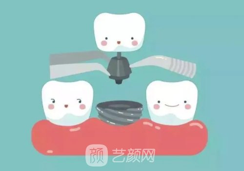 韩国仕诺康靠谱吗?性能优