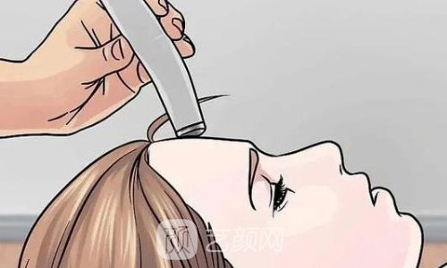 弗缦胶原蛋白的作用与功