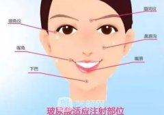 爱芙莱玻尿酸可以填充法