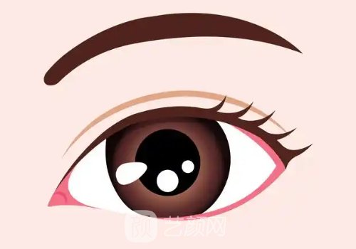 内眼角回包多久恢复自然