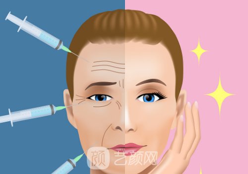 莫娜丽莎玻尿酸价格是多