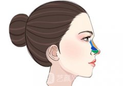 骨雕鼻子多少钱?耳软骨低