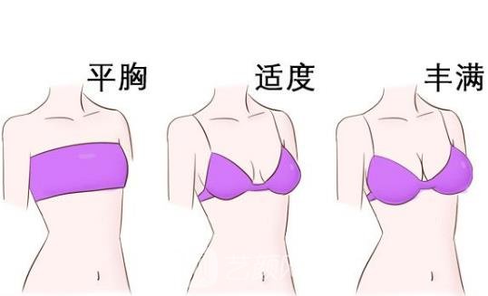 人工韧带乳房提升术的危