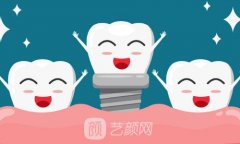 瑞士士卓曼iti价格是多少