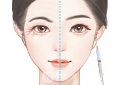 乔瑞嘉帝美尼提升针多久