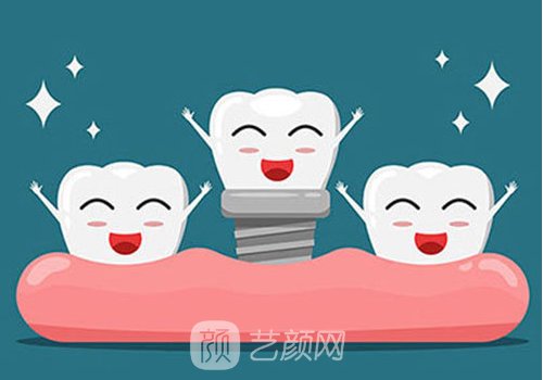 美国3i种植体官方网站更新