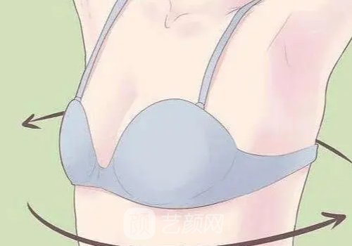 维维提升手术费用大概多