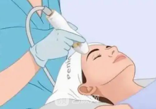 超声max和超声炮的区别有