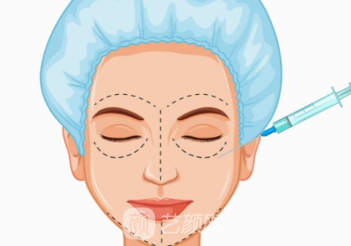 润致玻尿酸能维持多久?一