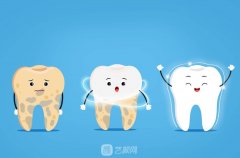 奥齿泰真实使用寿命：1