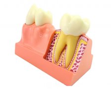 奥齿泰种植牙收费价目表