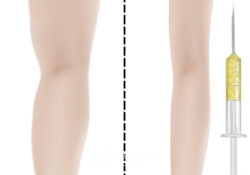 冰月岚绿溶脂的成分有哪