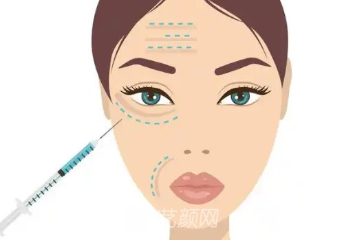 舒缇雅骨胶原价格是多少