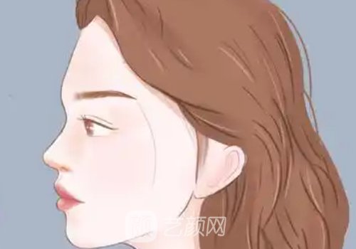 厦门做鼻子要多少钱?收费