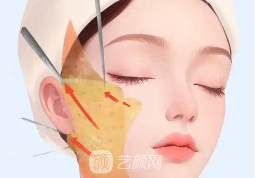 童颜微提3.0效果怎么样?很