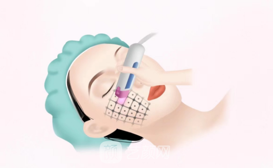 金达威聚拉美多久有效果