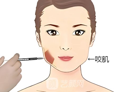 英伦大提升多少钱?价格及