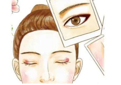 北京割双眼皮多少钱知乎