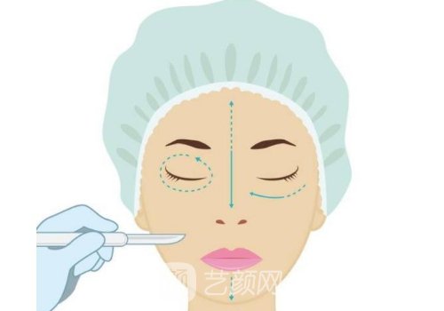 迈诺威溶脂针什么时候上