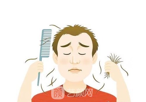 广州毛发种植贵不?内附