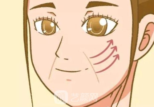 伊维兰5d童颜针多少钱一支