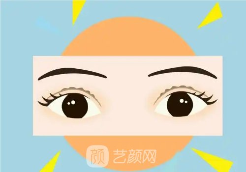 内双双眼皮图片案例分享