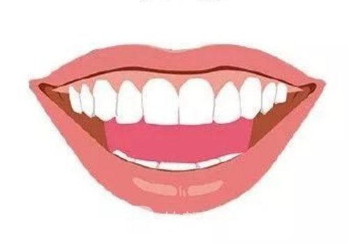 上海牙齿矫正费用大概多