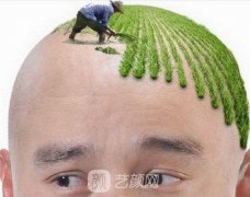 上海植发多少钱？大致参