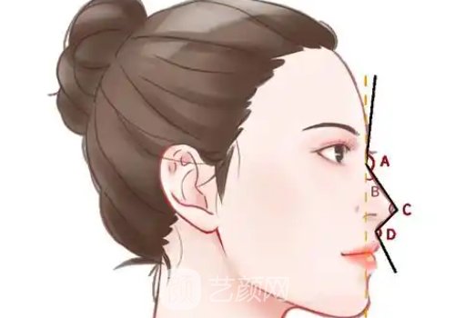 长春假体隆鼻贵吗?收费以