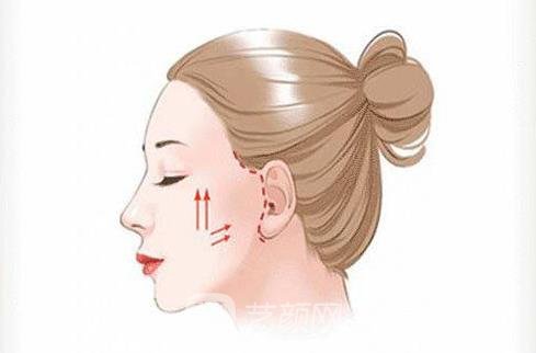 肤美达和双美的区别?技术