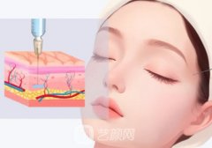爱贝芙缺点和后遗症有哪