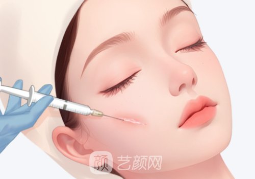 艾莉薇1500一只正常吗?技术
