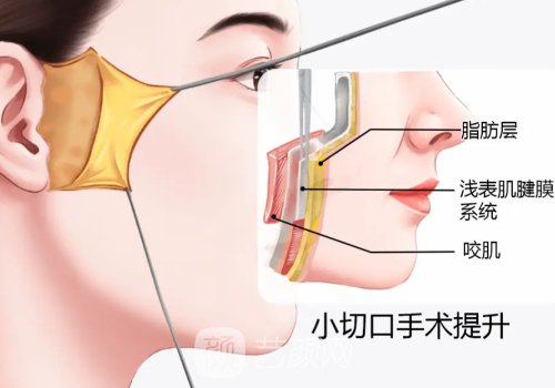 北京拉皮医生高亚东怎么