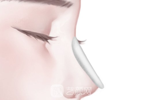 牛克辉做鼻子怎么样?技术