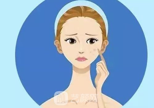 双燕尾拉皮就是小拉皮吗