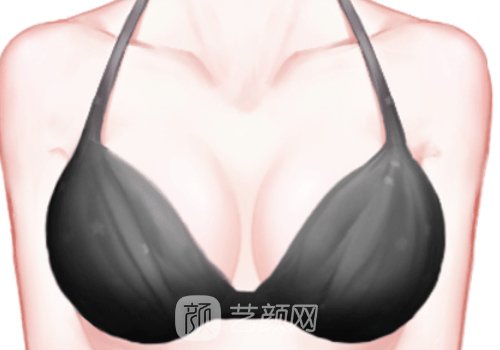 郝永生做的隆胸怎么样?广
