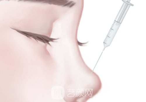 濡白天使隆鼻维持多久?一