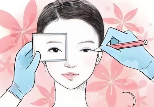 泰安公立医院割双眼皮价