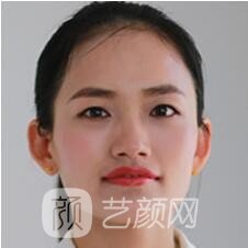 胡彩艳