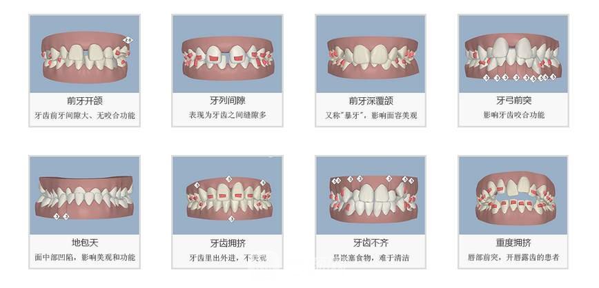 正畸