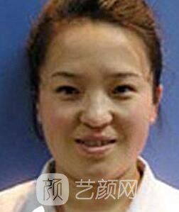 张静